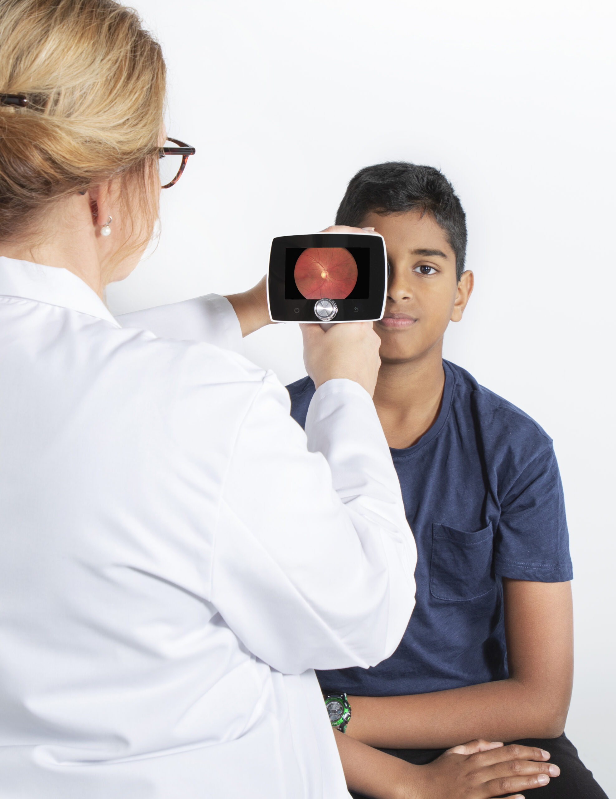 Optic disc image of a child shown on a Optomed Aurora camera display