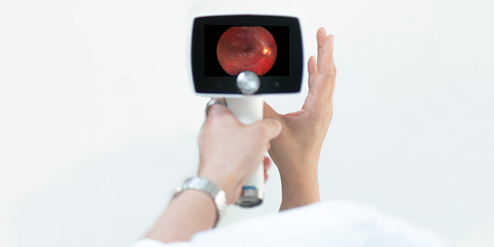 Optomed Aurora IQ handheld fundus camera